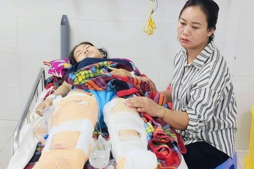 Cứu học sinh chạy ra đường, cô giáo mầm non bị xe tải cán phải cắt bỏ một chân