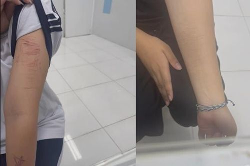 Trẻ dùng mạng xã hội quá sớm và cái giá phải trả là không nhỏ