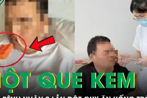 Bệnh nhân 2 lần đột quỵ có thể nuốt thức ăn trở lại chỉ bằng... 1 que kem