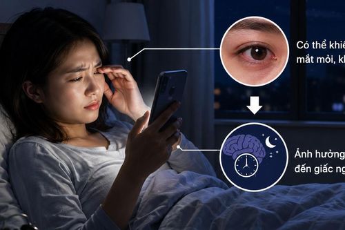 Lướt điện thoại trước khi ngủ gây khô, mỏi mắt khắc phục như thế nào?