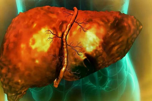 Hóa chất giặt khô có thể làm tăng gấp 3 lần nguy cơ xơ hóa gan