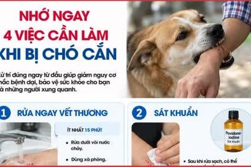 Nhớ ngay 4 việc cần làm khi bị chó cắn