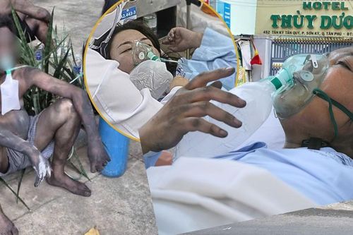 Du khách kể phút sinh tử mò mẫm tìm lối thoát trong khách sạn cháy ở TPHCM
