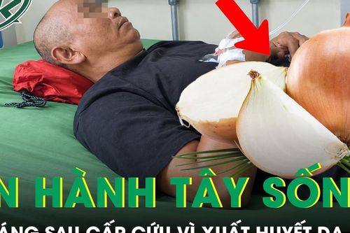 Ăn hành tây sống mỗi ngày chống ung thư, người đàn ông phải đi cấp cứu