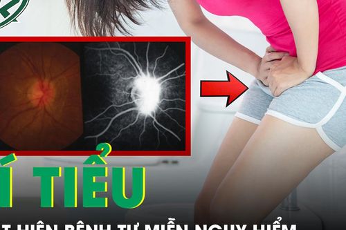 Bí tiểu kéo dài, người phụ nữ phát hiện bệnh tự miễn nguy hiểm