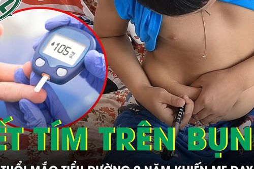 Bé trai 13 tuổi sống chung với tiểu đường 9 năm, chi chít những vết tím