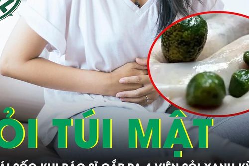 Cô gái 'sốc' khi bác sĩ gắp 4 viên sỏi xanh kỳ lạ trong túi mật