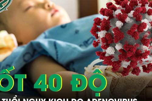 Bé trai 4 tuổi sốt 40 độ liên tục do Adenovirus, những dấu hiệu cần cảnh giác