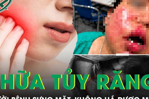 Sau điều trị tủy răng, người bệnh đái tháo đường sưng mặt, không há được miệng