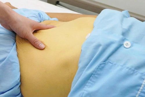 Tin thuốc nam trị đau khớp, người phụ nữ 62 tuổi nhận 'cái giá' đắt