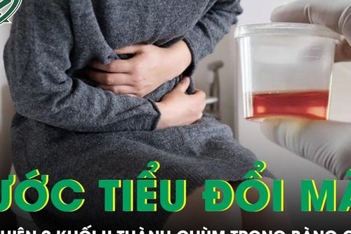 Nước tiểu chuyển màu, phát hiện 9 khối u thành chùm trong bàng quang