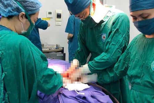 Báo động đỏ cứu bệnh nhân chửa góc sừng tử cung vỡ, mất hơn 2 lít máu