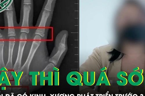 Bé gái 9 tuổi đã có kinh nguyệt, tuổi xương phát triển trước gần 3 năm