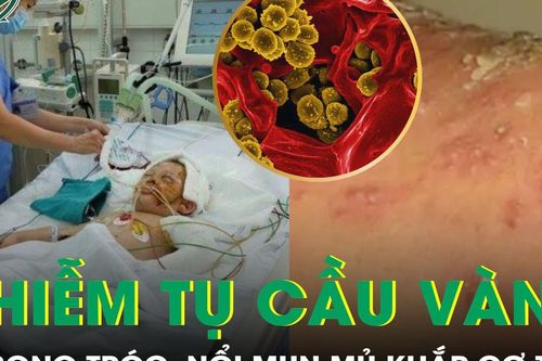 Nhiễm tụ cầu vàng, bé trai 3 tuổi da bong tróc, nổi mụn mủ khắp cơ thể