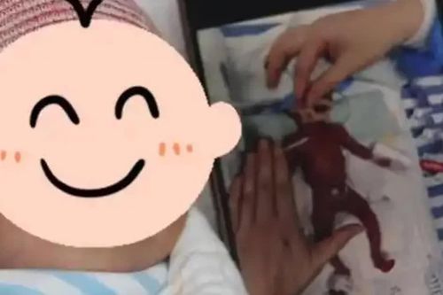Kỳ tích: Bé trai 330 gram chào đời ở tuần 23 tại Thâm Quyến xuất viện khỏe mạnh