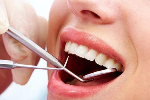 Những thói quen âm thầm làm hỏng răng