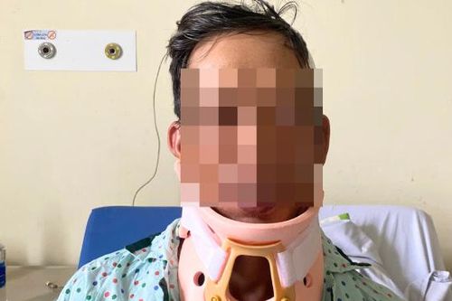 Té ngã võng, người đàn ông 43 tuổi gãy đốt sống cổ