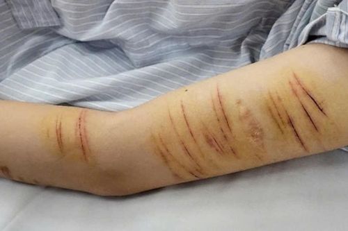 Khi mạng xã hội kéo trẻ vào vòng xoáy tự gây hại bản thân