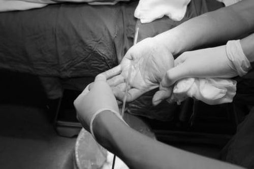 Thanh sắt đâm xuyên bàn tay, bác sĩ cảnh báo không tự ý rút dị vật