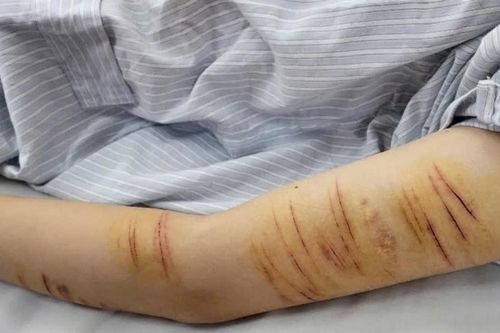 Mạng xã hội và 'cái bẫy' vô hình đẩy trẻ vào vòng xoáy tự gây thương tích