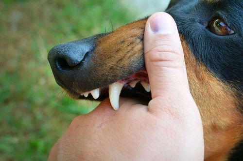 Hai trẻ nhỏ bị chó dữ lao vào tấn công, kết quả xét nghiệm khiến người dân lo lắng