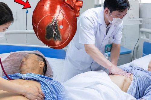 Cứu sống thành công hai vợ chồng bị nhồi máu cơ tim nguy kịch