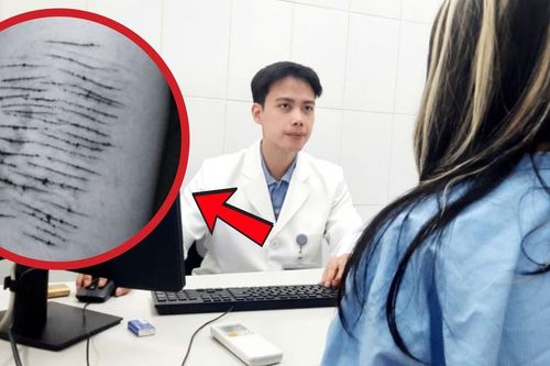 Nữ sinh 15 tuổi tự làm hại mình, rạch tay sau những ám ảnh mạng xã hội