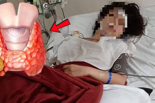 Người phụ nữ 34 tuổi phát hiện ung thư tuyến giáp từ dấu hiệu rất bình thường