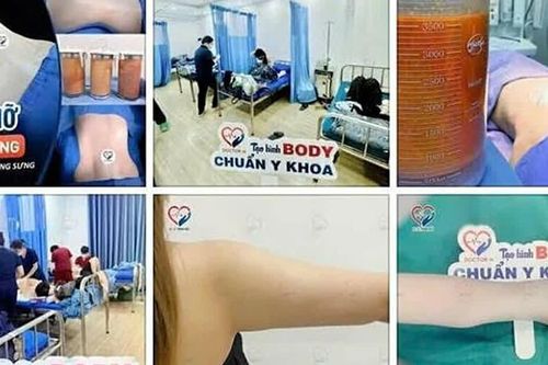 Khởi tố 6 đối tượng giả mạo bác sĩ để gây tê, hút mỡ tại cơ sở thẩm mỹ