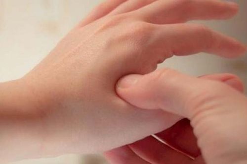 Nắng mưa thất thường, thử day 5 huyệt giúp giảm đau đầu