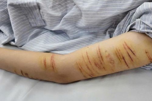 Vết rạch trên tay nữ sinh lớp 10 và nỗi đau không thể nói thành lời