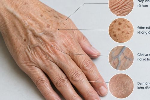 Vì sao da tay dễ lộ tuổi tác?