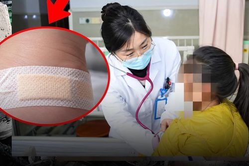 Bé gái sốt cao 2 ngày, thủ phạm dưới băng cá nhân ở gót chân