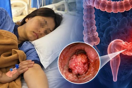 Nữ sinh mới 15 tuổi đã qua đời vì ung thư đại trực tràng giai đoạn cuối