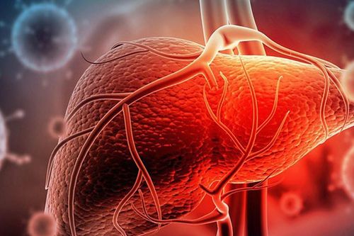 Men gan tăng cao có cần điều trị không?