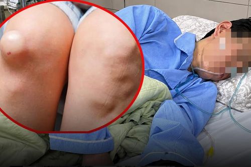 Người đàn ông phát hiện ung thư từ một dấu hiệu bất thường ở chân