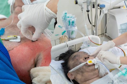 Tình hình sức khỏe 5 nạn nhân vụ cháy nhà giữa đêm ở TPHCM