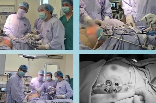 43 tuổi tình cờ phát hiện ung thư vú, phẫu thuật cắt tuyến vú và tái tạo