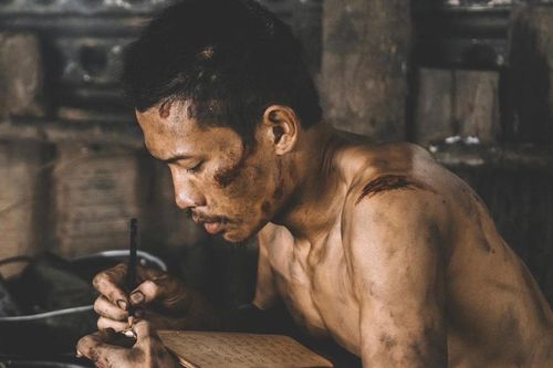 'Nam diễn viên khổ nhất màn ảnh Việt' bị rắn cắn phải nhập viện