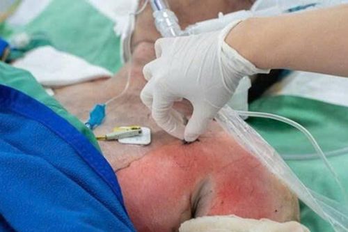 Vụ cháy nhà TP.HCM: Nạn nhân 15 tuổi sức khỏe xấu