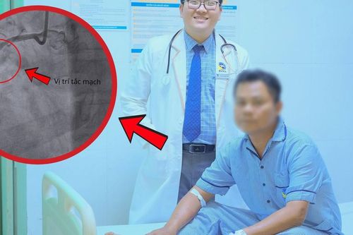 Đang khỏe mạnh, người đàn ông bất ngờ lên cơn nhồi máu cơ tim suýt chết