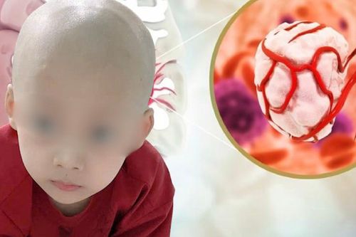 Bé trai 5 tuổi chống chọi ung thư giai đoạn cuối nửa năm không được về nhà