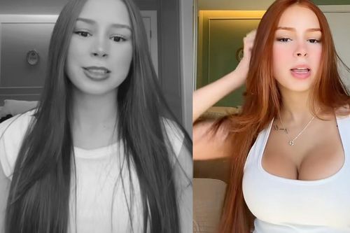 Nữ TikToker 22 tuổi qua đời, video cuối cùng hé lộ ca phẫu thuật vòng 1