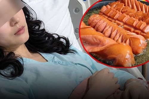 28 tuổi mắc bệnh thận, cô gái bàng hoàng khi biết nguyên nhân từ 2 món ăn yêu thích