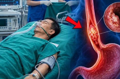 Làm 3 việc này suốt 30 năm, người đàn ông phát hiện mắc ung thư thực quản
