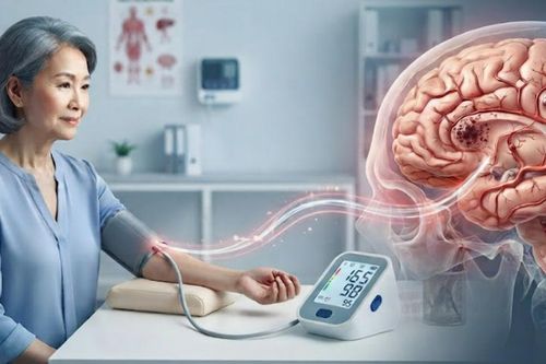 Huyết áp cao lâu năm ảnh hưởng tới não thế nào, cách kiểm soát để giảm nguy cơ?