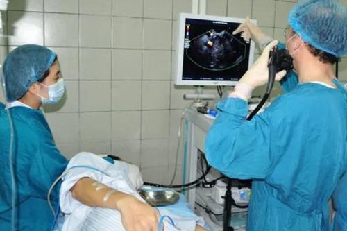 Vì sao cần phát hiện và xử lý polyp đại tràng?