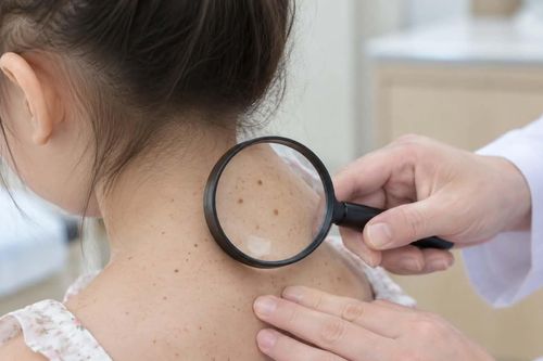 Căn bệnh khiến ánh nắng trở thành 'kẻ thù', nguy cơ ung thư tăng gấp nghìn lần