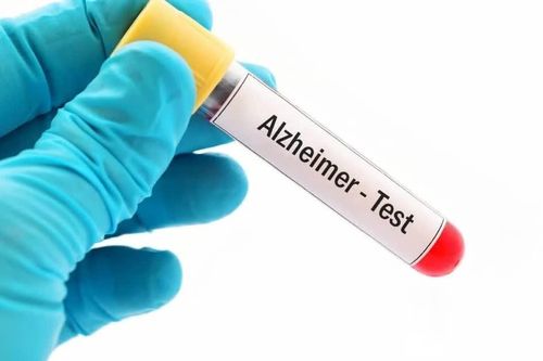 Triển vọng điều trị và phòng ngừa bệnh Alzheimer