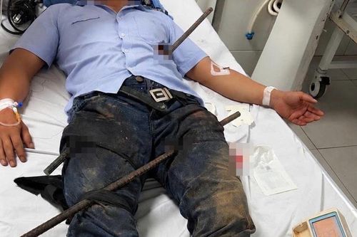 Kịp thời cứu bệnh nhân bị hai thanh sắt xuyên đùi và bụng